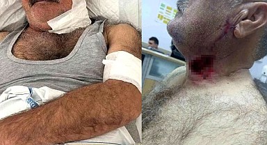 Sur İlçesinde Atın Saldırdığı Kişi Ağır Yaralandı